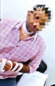 सोर्श गूगल फोटो - नायलॉन मांजा द्वारे जखमी झालेला ईसंम 