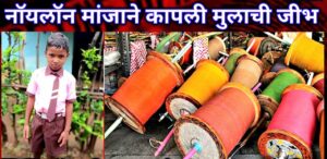 प्रतिक राऊत साकोली याची 70 टक्के जीभ मांजा मुळे कापल्या गेली